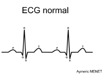 ECG normal